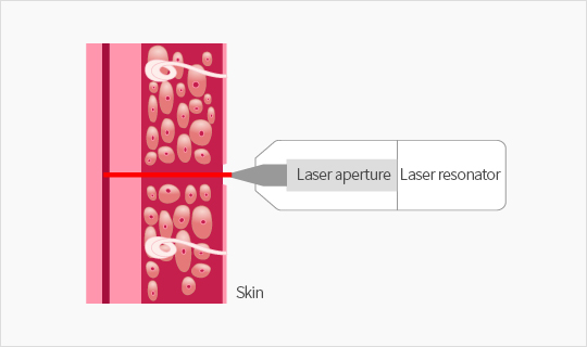 laser blood collector