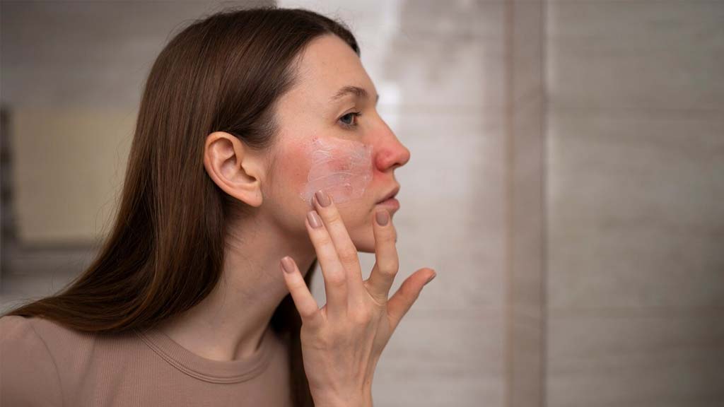 sensitive skins